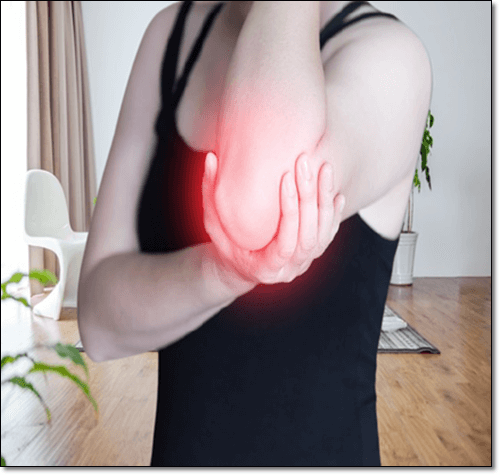 팔 관절염 환자