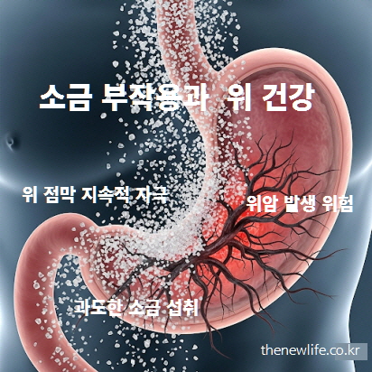 소금을 많이 먹으면 위 점막이 손상되고 위염·위궤양 위험이 증가하는 과정을 보여주는 이미지