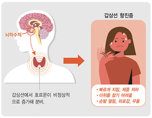 땀 많은 체질