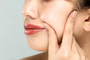 팔자주름-없애는-방법