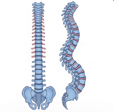 척추 측만증 증상과 원인 완벽 정리3