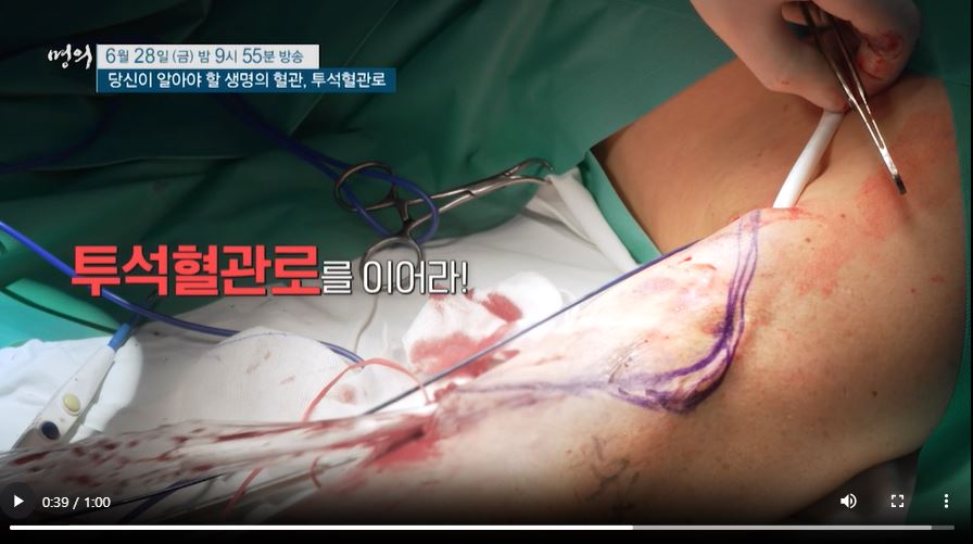 EBS 명의 혈액투석 투석혈관로