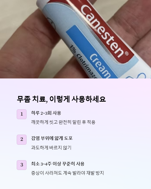 무좀 치료 이렇게 사용하세요