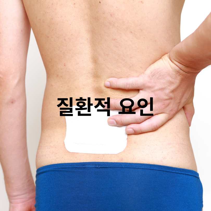 요통 원인과 요통 스트레칭 효과