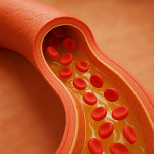 파로 곡물 효능 - 심혈관 건강