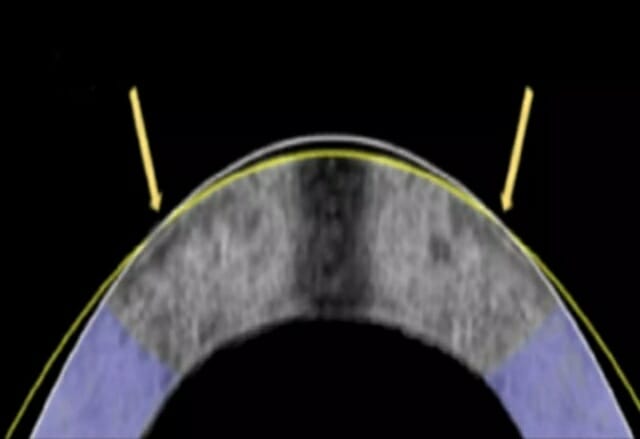 전기기계적 재형성(EMR) 기법을 설명한 그림 (사진= 마이클 힐 미국 옥시덴탈 칼리지 교수 외 / ACS 생체재료 과학 및 공학)