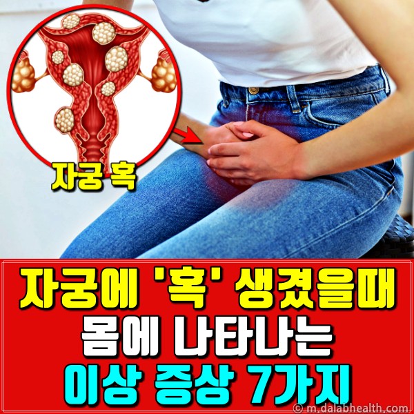 자궁 혹,자궁근종 증상 6,팁줌