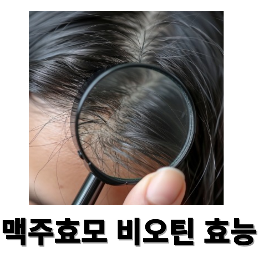 비오틴과 관련된 사진입니다.