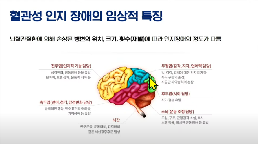 혈관성 인지장애(치매)의 병변 특징