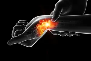 손목 터널 증후군 병원