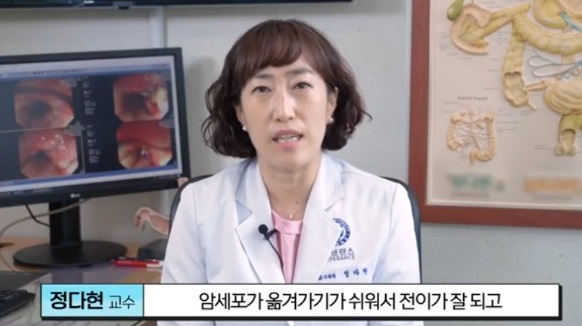 EBS명의-식도암
