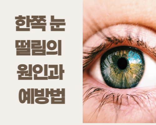 한쪽 눈 떨림의 원인과 예방법