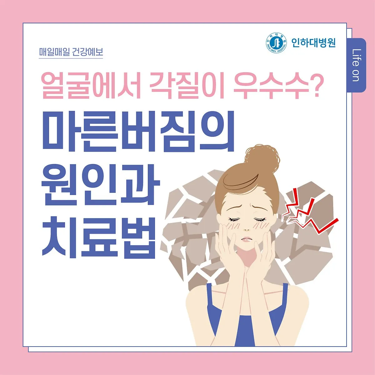 얼굴 버짐 증상 없애는 실전 방법 5가지 및 관리요령_9