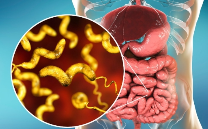 장염의 진단 방법