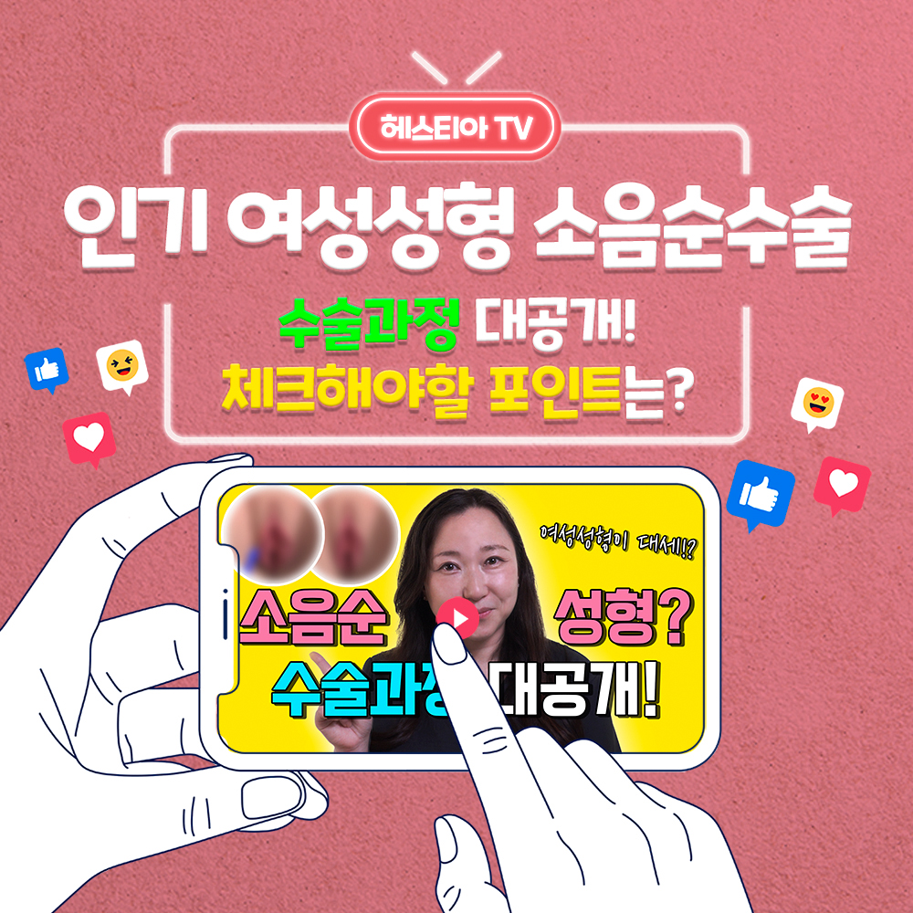 소음순성형 과정 대공개! 소음순수술 시 주의사항은 뭘까?