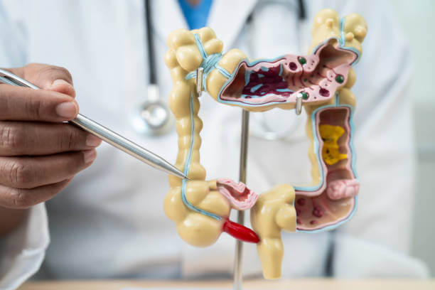 복통과 혈변, 혹시 궤양성 대장염? 초기 증상은 이렇게 시작된다