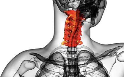 식도암 초기증상 29