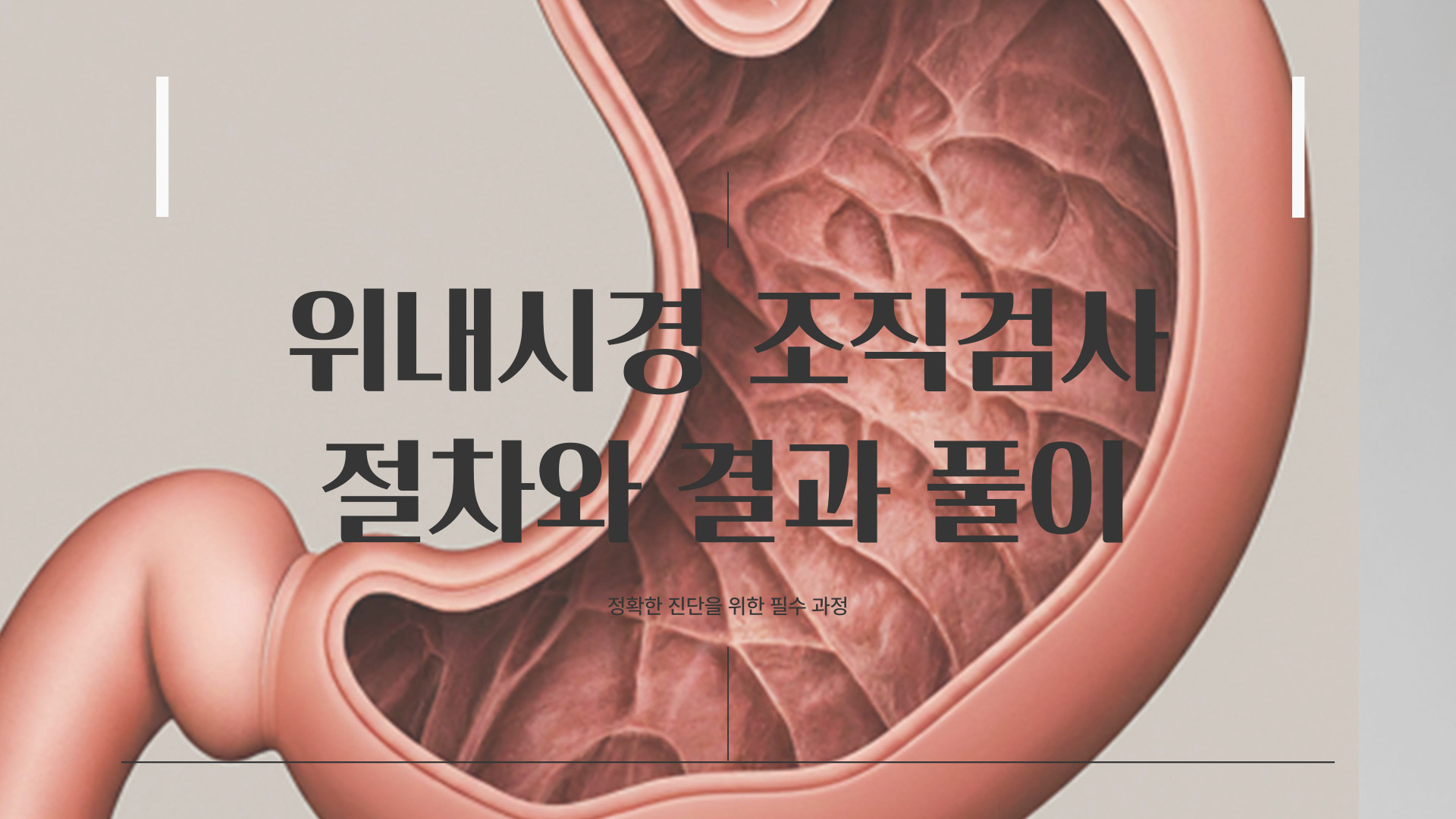 위내시경 조직검사