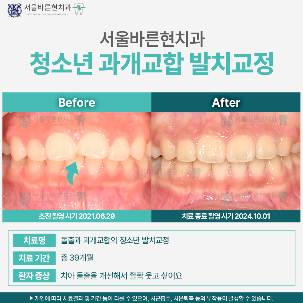 부산교정치과