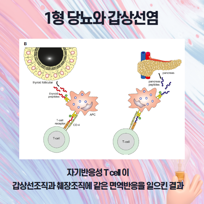 당뇨와 갑상선 질환에는 서로 어떤 관계가 있을까요?