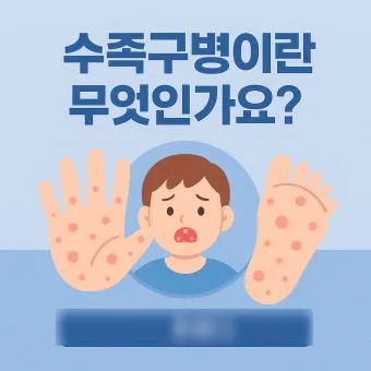 수족구 초기 증상 어른 감염 격리기간 예방 치료 완전 가이드_8