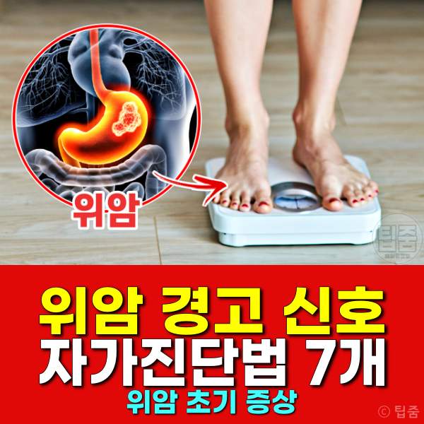 위암 증상,위암 초기증상 자가진단,체중 감소