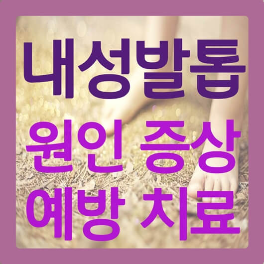 내성발톱 원인 증상 예방 치료 교정기