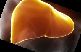 아보카도 보관법