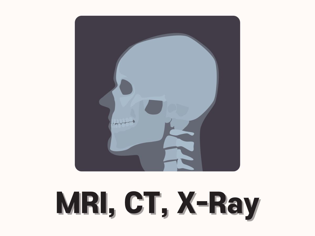 MRI, CT, X-ray 방사선량 차이