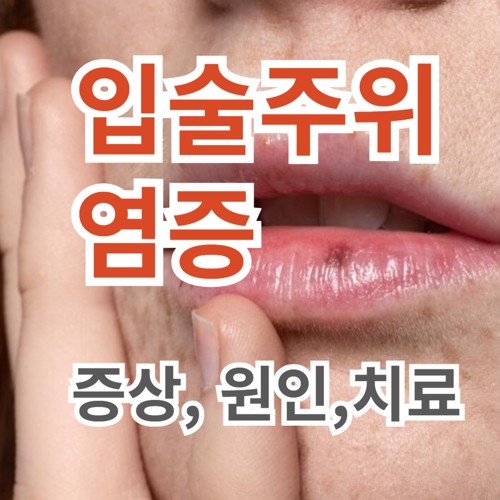 입아래, 입술주위, 입술주변 뾰루지, 여드름 원인과 치료