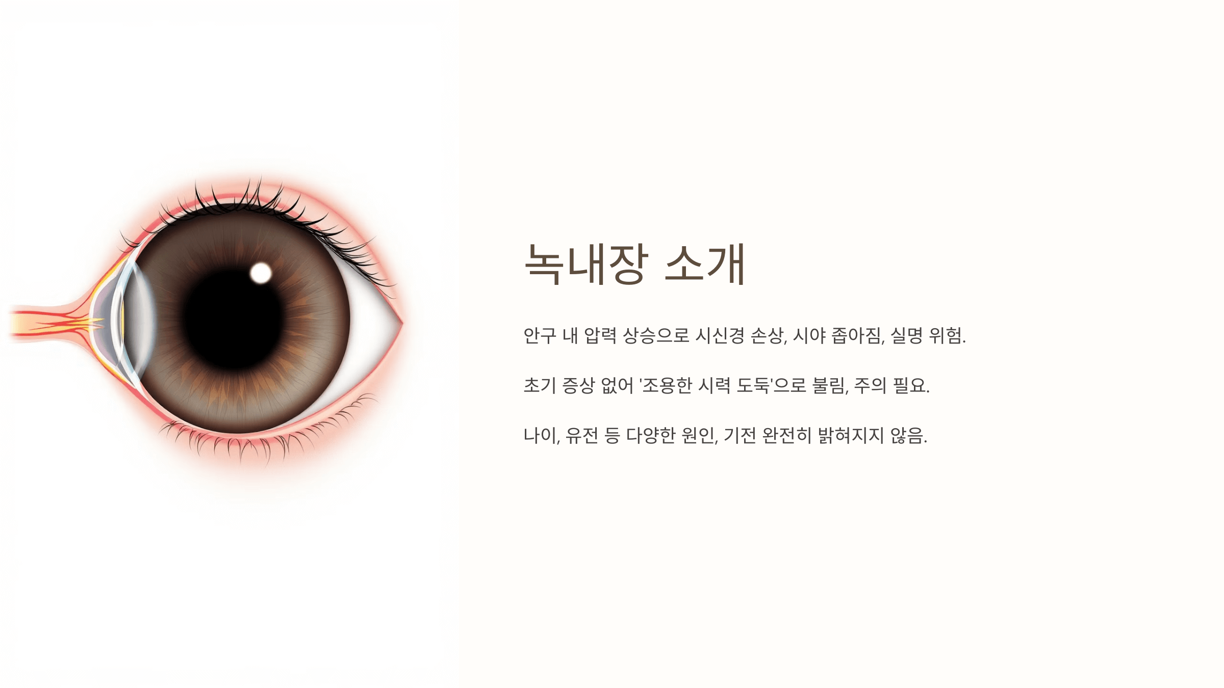 녹내장과 관련된 사진입니다.