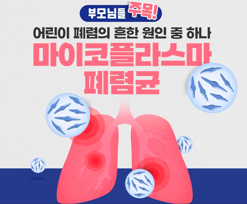 어린이 폐렴의 주요 원인