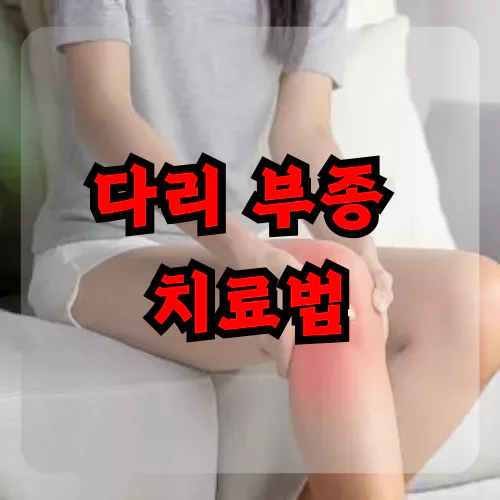 다리 부종 치료법