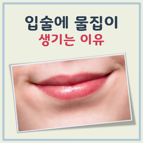 입술에 물집이 생기는 이유