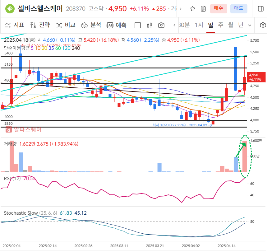 셀바스헬스케어 일봉차트