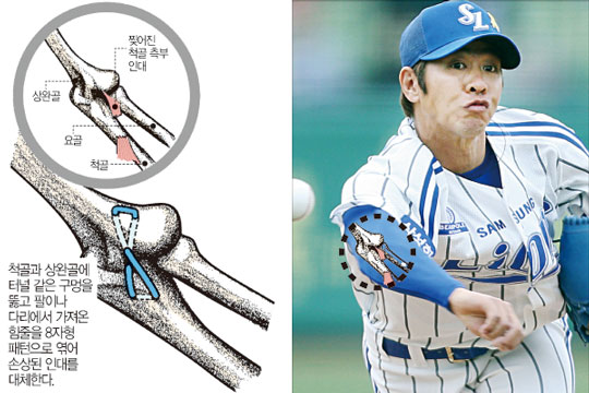 류현진 한화 복귀 8년 170억원 계약 잭팟 LA 다저스 토미존 서저리