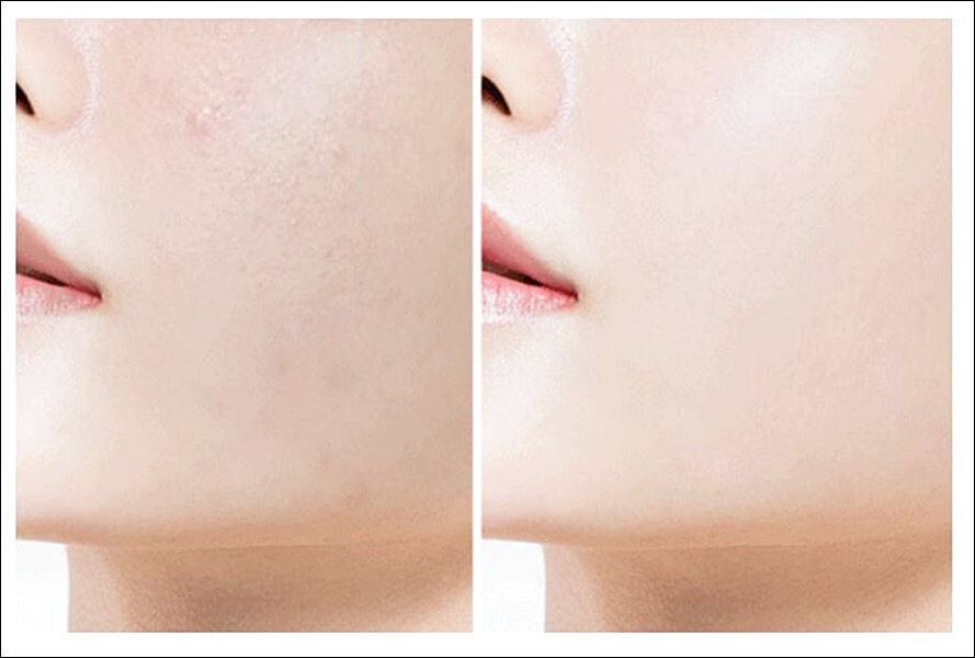 화려화 가격 및 효과 (강성연 이너뷰티)