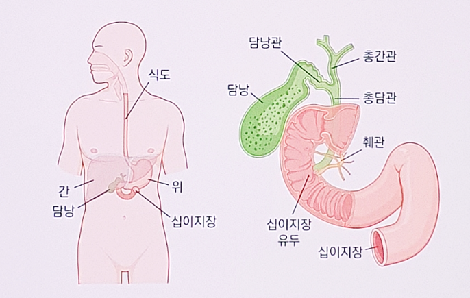 담도암 생존율과 병기별 예후