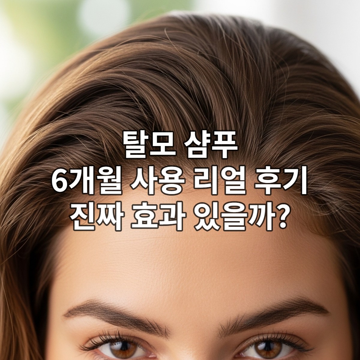 6개월간 탈모 샴푸 사용 후 건강해진 두피와 풍성한 모발을 자신감 있게 보여주는 사람의 모습.