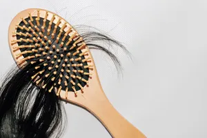 원형탈모-치료법