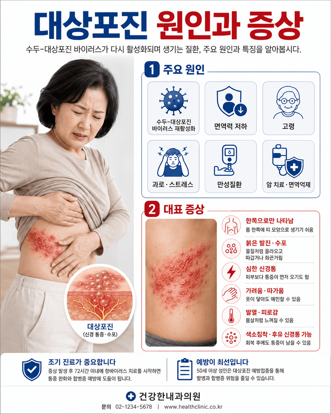 대상포진 원인과 증상
