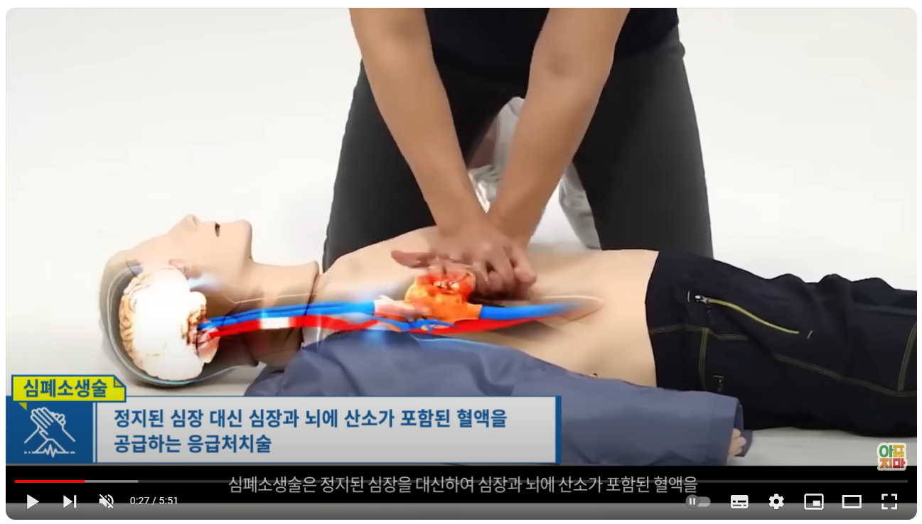 심폐소생술 하는 법