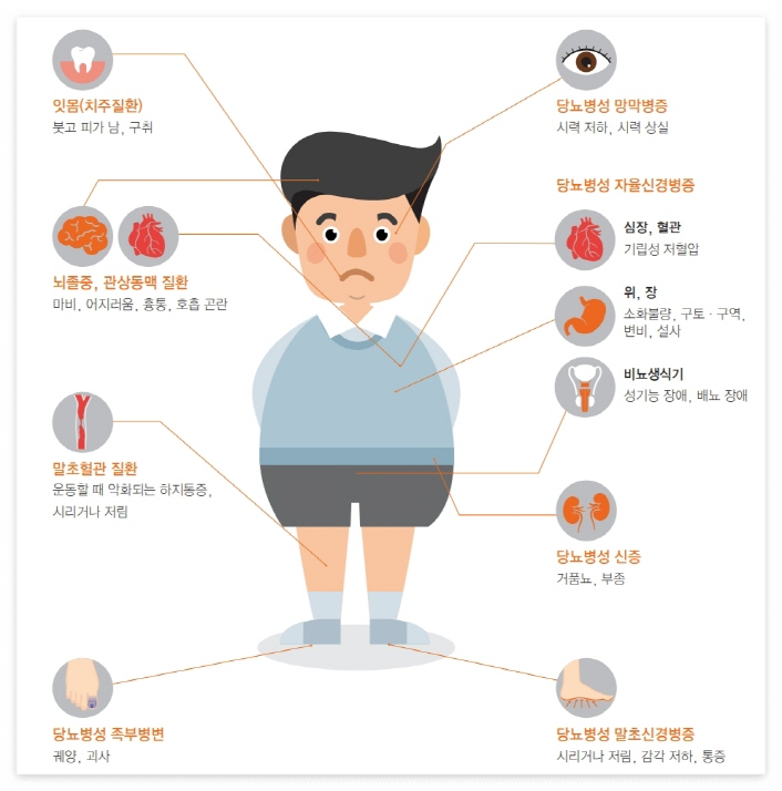 당뇨 합병증