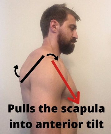 어깨뼈 전방경사