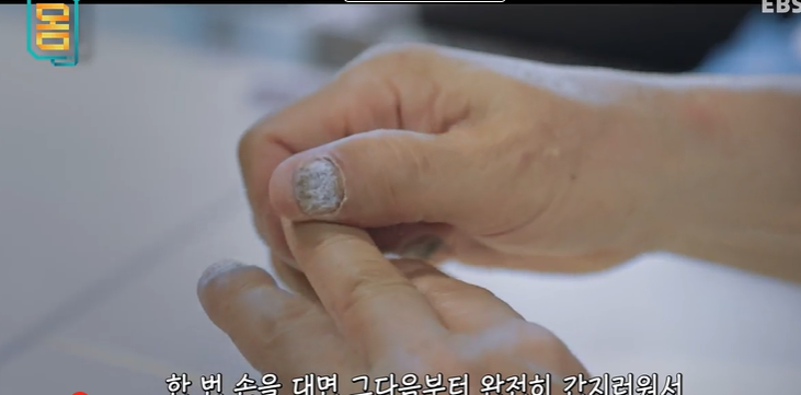 무좀 원인과 해결