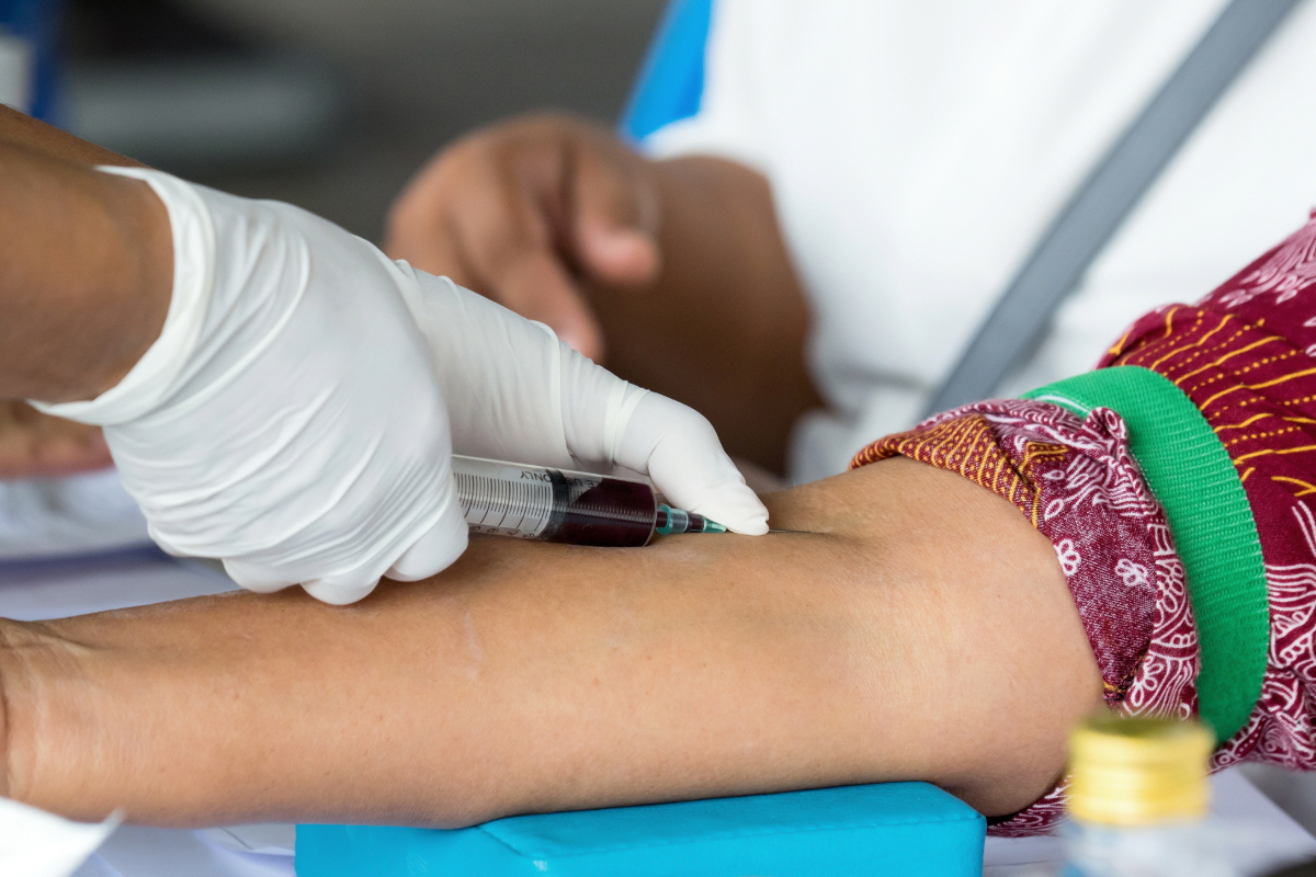 간 수치 낮추는 방법