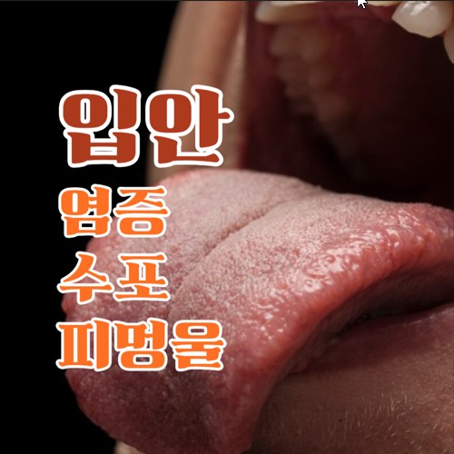 입안 염증, 수포, 피멍울 - 원인과 해결 방법
