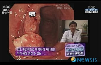 면역력과 암 발생