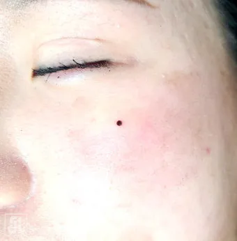 입술 밑 점 관상 참고 정보_20