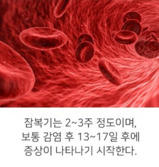 대상포진 수두바이러스